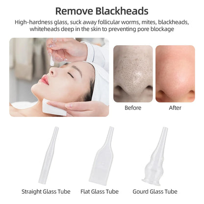 Professional Facial Diamond Microdermabrasion Machine