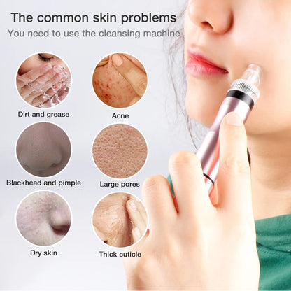 Microbubble Blackhead Remover