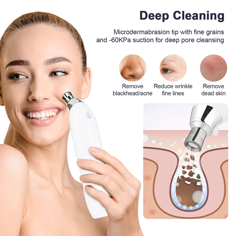 Portable Diamond Microdermabrasion Facial Peeling Machine