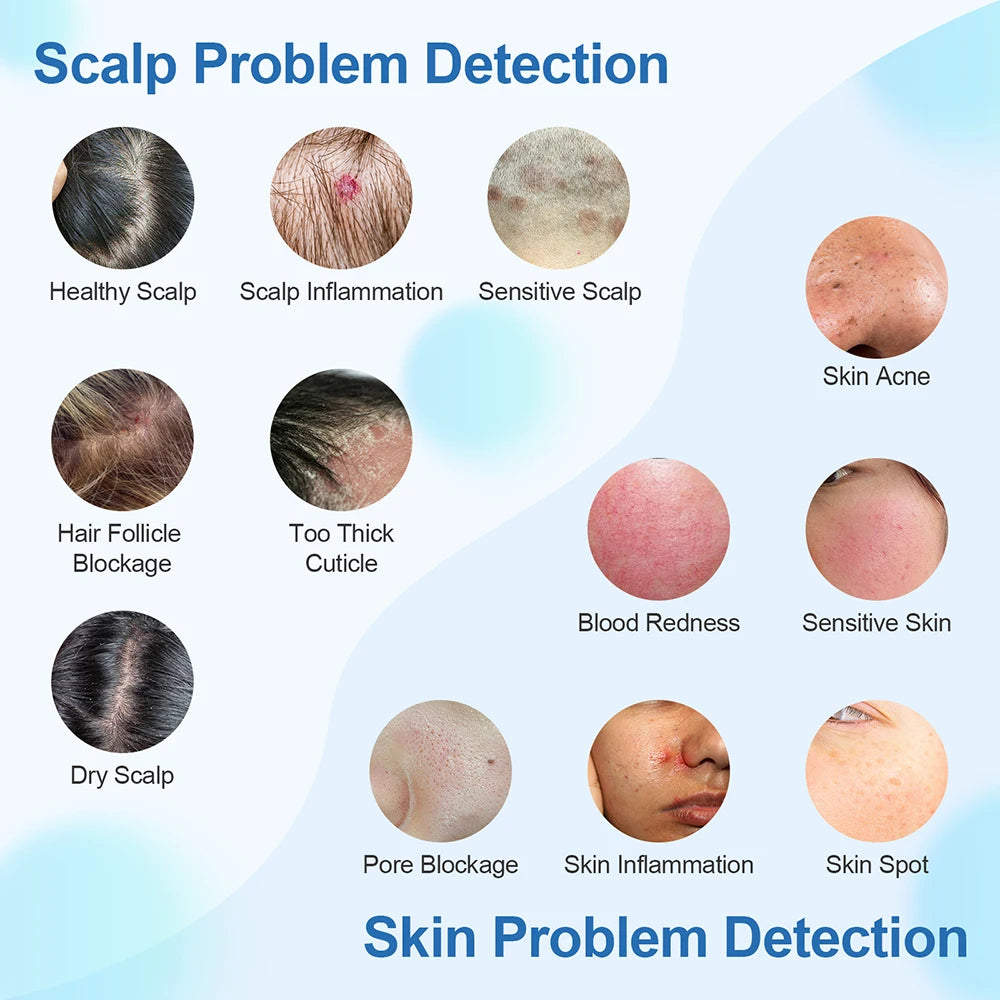 Portable Hair Follicle Scalp Detector