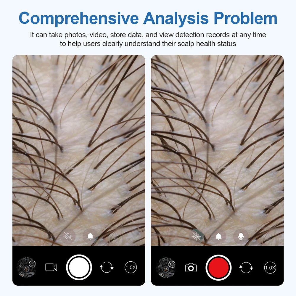Portable Hair Follicle Scalp Detector